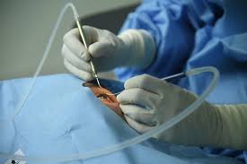 Mumbai, Medical, Best Eye Hospital In Trivandrum For Advanced Eye Care And Trusted Treatment
