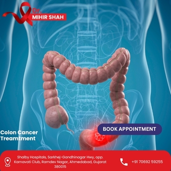 Ahmedabad, Health, Get Faster Recovery With The Best Colon Cancer Treatment In Ahmedabad