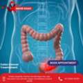 Get Faster Recovery With The Best Colon Cancer Treatment In Ahmedabad
