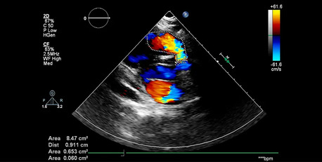 Sharjah, Medical, Colour Doppler Ultrasound Sharjah