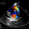 Colour Doppler Ultrasound Sharjah