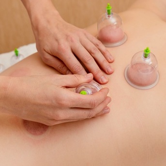 London, Business, Expert Cupping Therapy In Eastleigh &ndash; Feel Refreshed & Rejuvenated