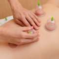 Expert Cupping Therapy In Eastleigh &ndash; Feel Refreshed & Rejuvenated