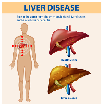 Mumbai, Health, Best Herbs Used In Ayurvedic Treatment For Liver Disorders