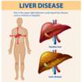 Best Herbs Used In Ayurvedic Treatment For Liver Disorders