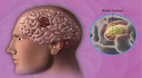 Mumbai, Health, What Are The Common Causes Of Hair Fall And Hair Thinning?
