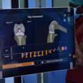 Robotic Knee Hip Replacement Surgery In Madurai