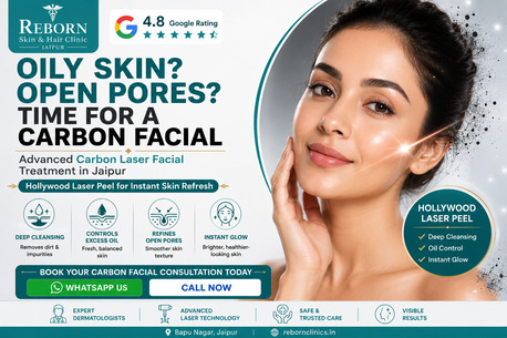 Jaipur, Health & Beauty Items, INR 3999,  Carbon Facial In Jaipur For Oily Skin & Open Pores