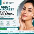 INR 3999,  Carbon Facial In Jaipur For Oily Skin & Open Pores
