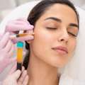 The Science Behind PRP For Face In Dubai: How It Supports Natural Skin Recovery