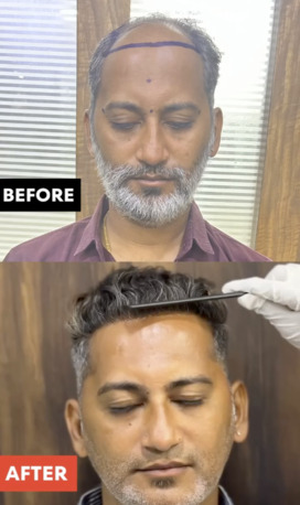 New Delhi, Health, Professional Cosmetic & Skin Care