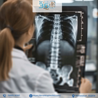 Mumbai, Health, Early Treatment For Spinal Fractures Can Improve Recovery