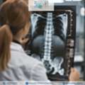Early Treatment For Spinal Fractures Can Improve Recovery