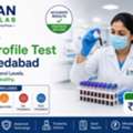 Reliable Lipid Profile Test In Ahmedabad At Nidan Path Lab