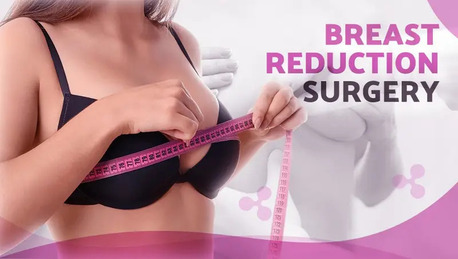 New Delhi, Medical, Looking For Breast Reduction Surgery In Delhi? Book A Consultation Today