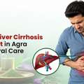 Effective Liver Cirrhosis Treatment In Agra With Natural Care