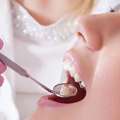 Professional Teeth Whitening In Shrewsbury For Safe Results
