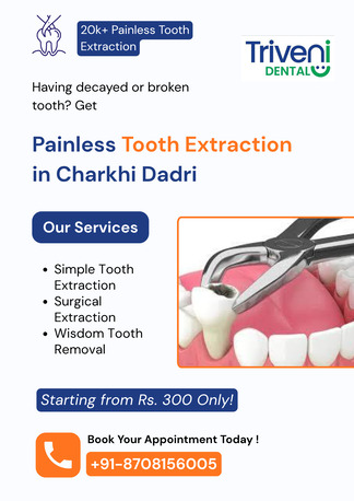 Haryana, Dental, Painless Tooth Extraction Treatment In Charkhi Dadri | Triveni Dental