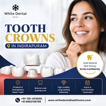 Ghaziabad, Dental, Tooth Crowns In Indirapuram For Restoring Damaged Teeth