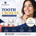Tooth Crowns In Indirapuram For Restoring Damaged Teeth