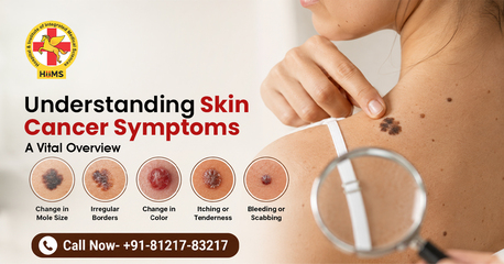 Chandigarh, Health, Skin Cancer Symptoms: Don&rsquo;t Ignore Early Warning Signs