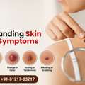 Skin Cancer Symptoms: Don&rsquo;t Ignore Early Warning Signs