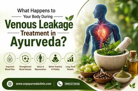 New York, Health, What Happens To Your Body During Venous Leakage Treatment In Ayurveda?