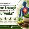 What Happens To Your Body During Venous Leakage Treatment In Ayurveda?