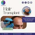 Get A Younger, Fuller Look With A Hair Transplant In Ahmedabad