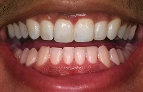 London, Dental, London City Dentists