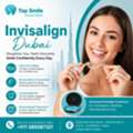 Invisalign Dubai | Clear Aligners At Top Smile Dental Clinic