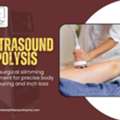 Ultrasound Lipolysis Technique For Enhanced Body Shape And Tone
