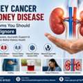 Looking For Kidney Cancer Care In Bangalore? Start Your Wellness Journey