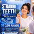 Transform Your Smile With Invisalign Aligners - Start Today