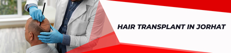 Mumbai, Health, Hair Transplant In Jorhat | Dr Paul Hair & Skin Clinic