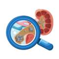 Advanced RIRS Treatment In Nagli &ndash; Safe & Effective Kidney Stone Removal