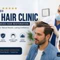 Top Rated FUT Hair Clinic For Advanced Hair Restoration