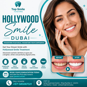 Dubai, Dental, Hollywood Smile Dubai &ndash; Transform Your Smile With Confidence At Top Smile Dental Clinic