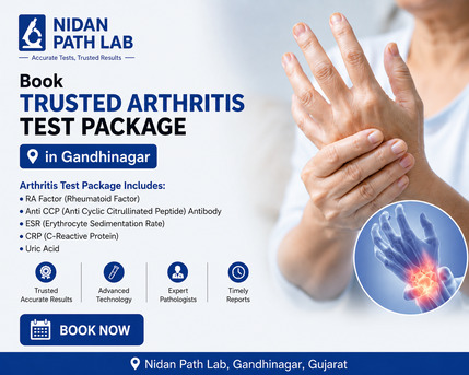 Ahmedabad, Health, Book Arthritis Profile Test In Gandhinagar At Nidan Path Lab