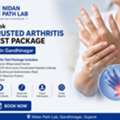 Book Arthritis Profile Test In Gandhinagar At Nidan Path Lab