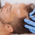 Hair Restoration In Kalispell For Fuller And Healthier Hair