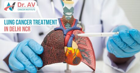 Gurgaon, Medical, Trusted Lung Cancer Treatment In Delhi NCR With Advanced Therapies