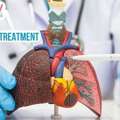 Trusted Lung Cancer Treatment In Delhi NCR With Advanced Therapies