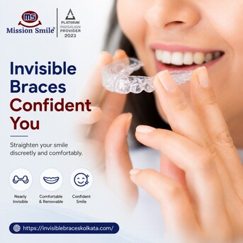 Kolkata, Dental, Invisible Braces Treatment Kolkata