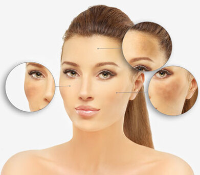 New Delhi, Health, Pigmentation Treatment In Delhi | Skin Pigmentation Specialist