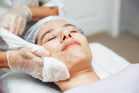 New Delhi, Health, Pigmentation Treatment In Delhi | Skin Pigmentation Specialist