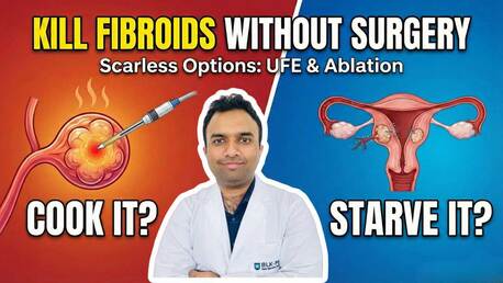 New Delhi, Health, Advanced Uterine Fibroids Treatment In Delhi NCR | Dr Akash Bansal