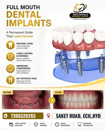 Hyderabad, Dental, Advanced Dental Clinic In Sainikpuri For Dental Implants