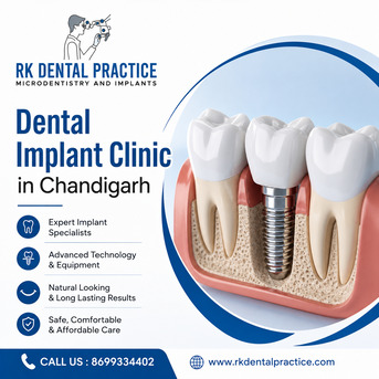 Chandigarh, Dental, Dental Implant Clinic In Chandigarh For Advanced Tooth Replacement