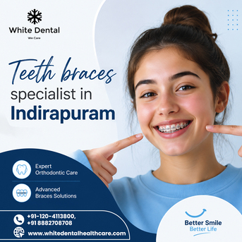 Ghaziabad, Dental, Teeth Braces Specialist In Indirapuram For Better Smile Alignment